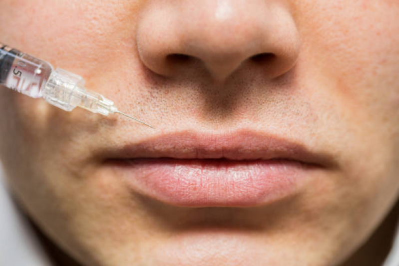 Clínica Especializada em Aplicação de Toxina Botulínica nos Lábios Portal Laranjeiras - Aplicação de Toxina Botulínica Facial