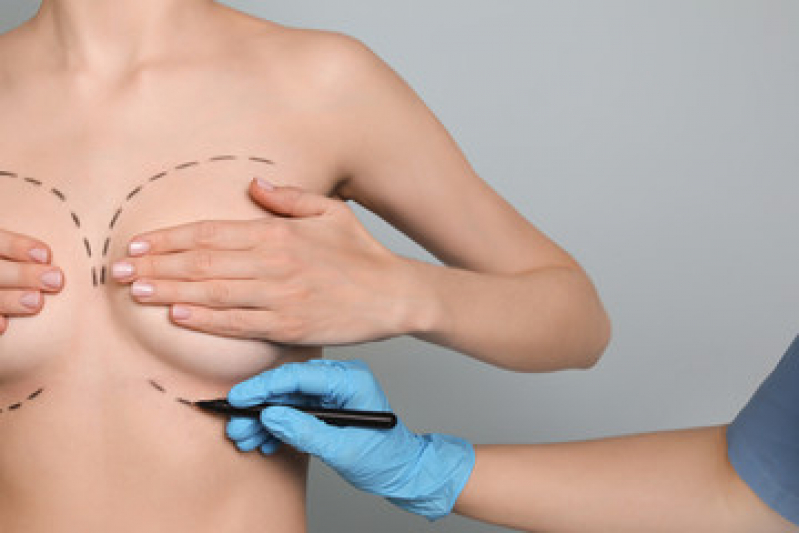 Onde Fazer Cirurgia de Mamoplastia de Aumento Joanópolis - Cirurgia de Prótese de Silicone