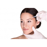 aplicação de toxina botulínica facial clínica Carapicuíba