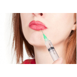 aplicação de toxina botulínica nos lábios Itapeva