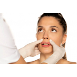 cirurgia de harmonização no nariz Pirassununga
