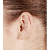 cirurgia de orelha rasgada agendar Charqueada