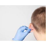 cirurgia de orelha Amparo