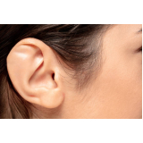 clínica que faz cirurgia para orelha rasgada Arujá